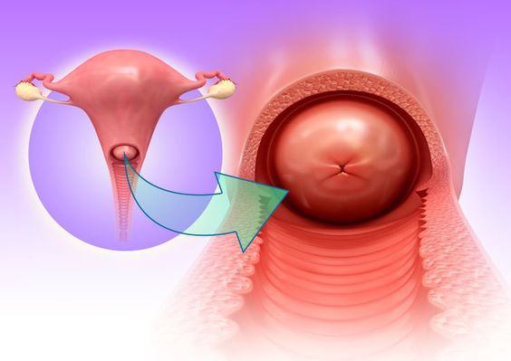 Women Health/Cervical Cancer  
