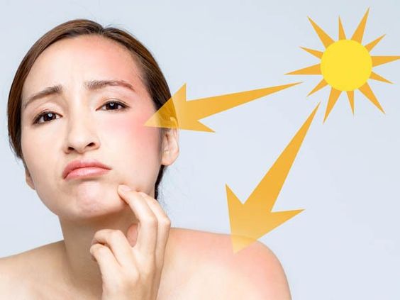 Sun protection summer skin care tips